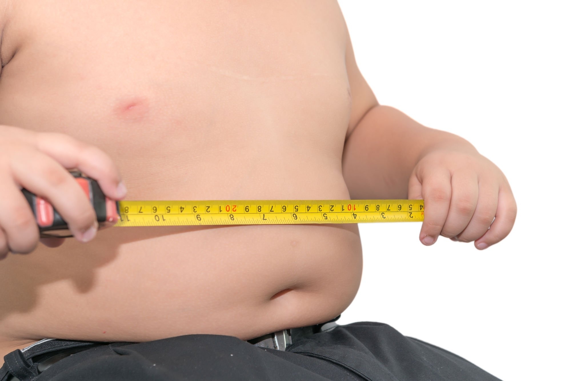 Protecting Children from Obesity: A Vital Responsibility for a Healthy Future